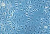 LONZA原代人冠状动脉内皮细胞HCAEC和培养基